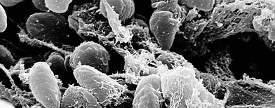 Esta bacteria fue el detonante de la Peste bubónica en Europa. (Wikimedia Commons)