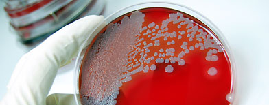 The Science of Microbiology (Thinkstock)