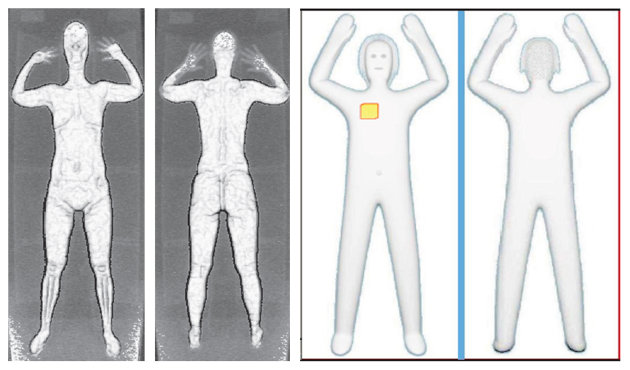 These two sets of images provided by the Transportation Security Administration are samples that show details of what TSA officers see on computer monitors when passengers pass through airport body scanners. At left are two images using backscatter advanced image X-ray technology from the huge scanners that were introduced in 2010 at O'Hare International Airport in Chicago and other airports. At right are images from new scanners using new millimeter wave technology that produces a cartoon-like outline rather than naked images of passengers produced by using X-rays. (AP Photo/Transportation Security Administration)