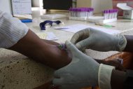 Um primeiro ensaio clínico com 175 pessoas está previsto para começar no final deste ano nos Estados Unidos, Brasil, África do Sul e Malawi, com a mesma terapia antirretroviral