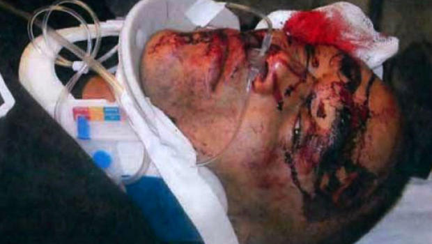 'That's when I expected to be shot' (WARNING: contains graphic image) 5eb9344106cc3dd754028022d1c470ff