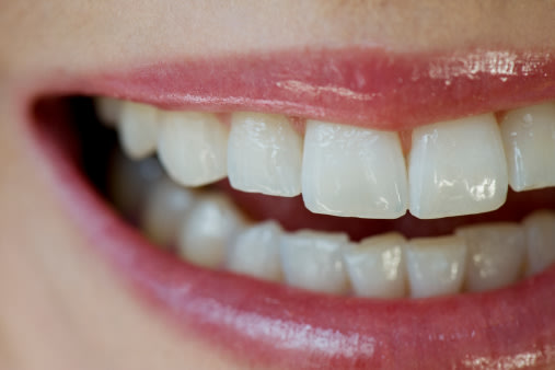 ما أسباب تآكل الأسنان وكيف يمكن منعه؟ 90207121-jpg_115000