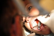 Os cientistas descobriram uma relação direta entre a limpeza dos dentes e uma incidência menor de infarto e AVC