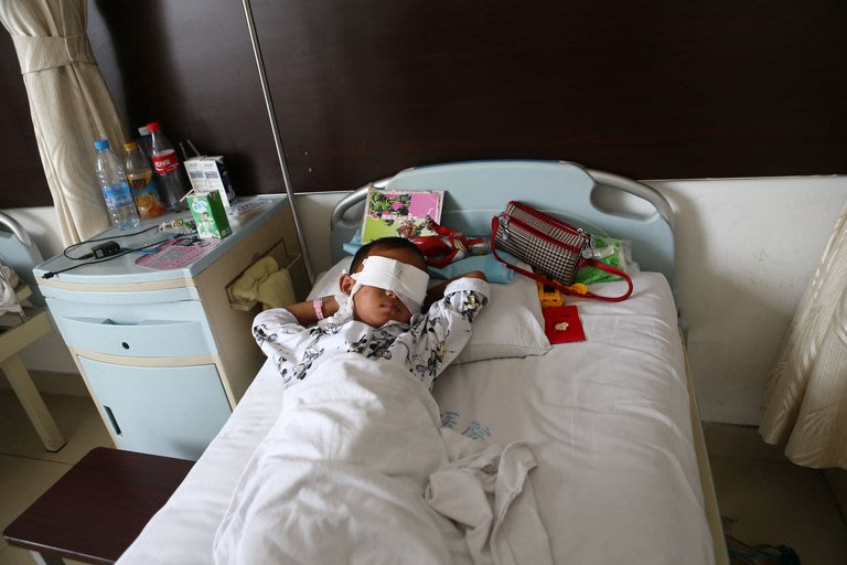 A boy lies with his eyes covered with bandages in a hospital in Taiyuan, north China's Shanxi province on August 27