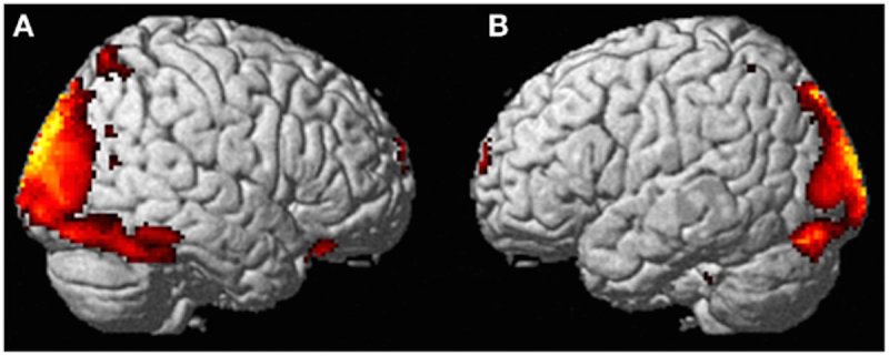 brain scan inhibited areas