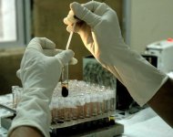Exame de amostras de sangue em um laboratório