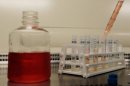 A researcher at the International AIDS Vaccine Initiative laboratory works on samples at the lab
