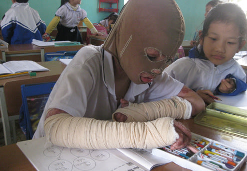 Cậu bé lớp 1 đeo mặt nạ vải đến trường Beminh1-jpg_045110