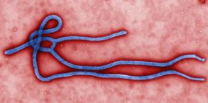 Uma imagem micrografia eletrônica de um virion vírus Ebola ...