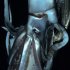 Still image taken from video shows a giant squid near Ogasawara islands