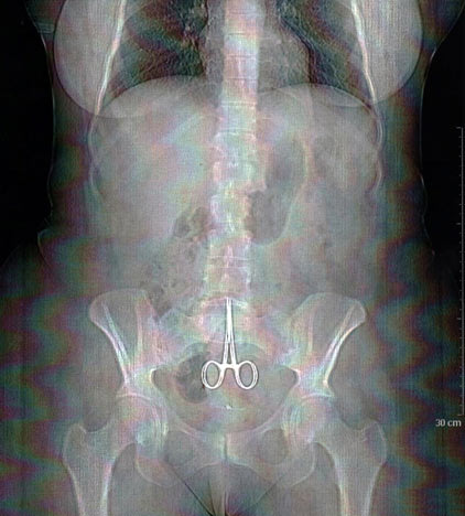 Shocking X-Rays