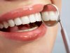 Δόντια που δεν σαπίζουν και φαίνονται πιο λευκά χάρη σε νέο υλικό