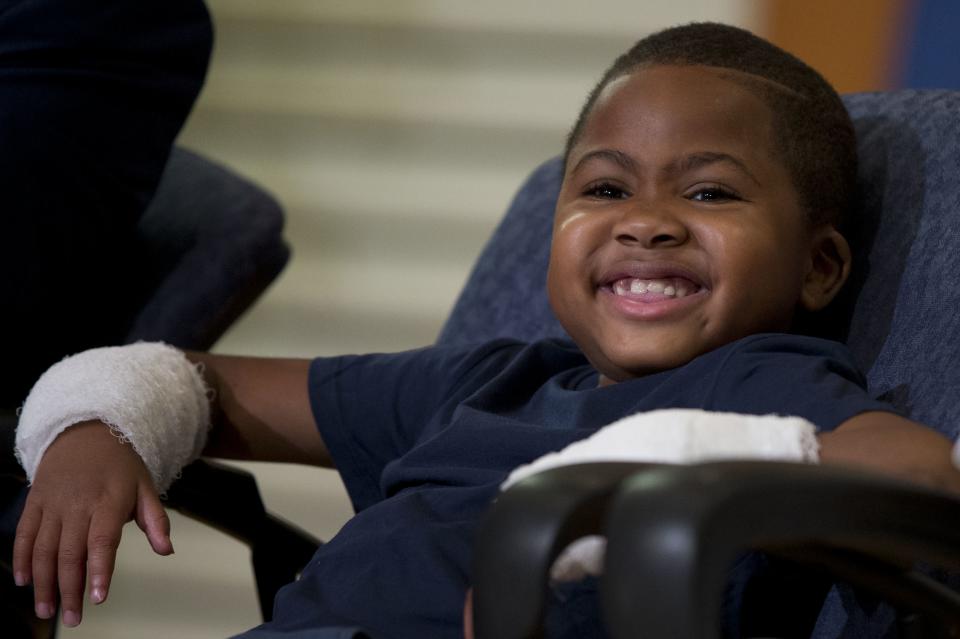 Double-hand transplant recipient eight-year-old Zion Harvey smiles during a news conference Tuesday, July 28, 2015, at The Children’s Hospital of...