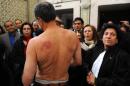Man takes off shirt during a meeting in Tunis, Tunisia, on December 29, 2010, to show to human rights activists marks of torture on his body inflicted by police