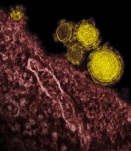 <p> This undated electron microscope image made availalbe by the National Institute of Allergy and Infections Diseases - Rocky Mountain Laboratories shows novel coronavirus particles, also known as the MERS virus, colorized in yellow. The mysterious new respiratory virus that originated in the Middle East spreads easily between people and appears more deadly than SARS, doctors reported Wednesday, June 19, 2013 after investigating the biggest outbreak in Saudi Arabia. (AP Photo/NIAID - RML)