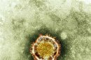 A SARS coronavirus is seen in this undated handout photograph released in London