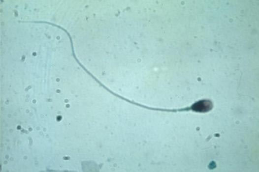 Le délicat transport du génome par le spermatozoïde