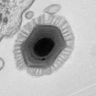 Foto mostra o megavírus chilensisa, que detinha o recorde de maior vírus até o momento, com 1200 genes