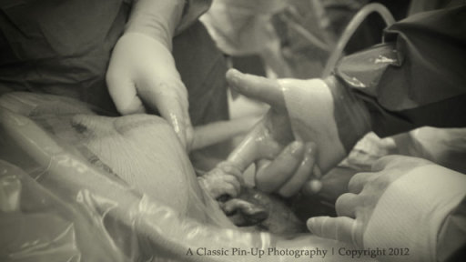 Infant in Womb Holds Doctor's Hand
