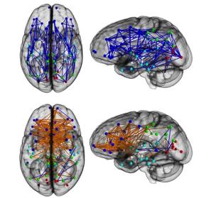 How Men's Brains Are Wired Differently Than Women's