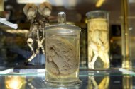Cérebro é conservado no museu Dupuytren, d afaculdade de medicina de Paris, em 10 de julho de 2013