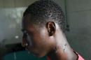 Alassane Diallo, 17, a supporter of presidential candidate Cellou Dalein Diallo, sits on a bed at a clinic after being wounded on his neck by a bullet during clashes between security forces and opposition supporters, in Conakry