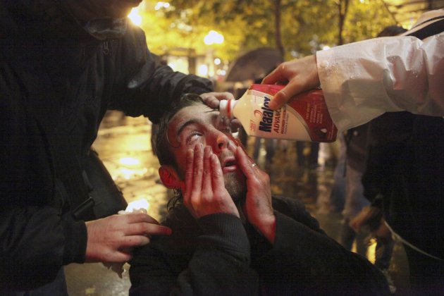 A man is treated by fellow protesters after he was sprayed in the face with pepper spray by police during the Occupy Seattle&#39;s protest in Seattle