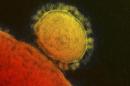 Handout transmission electron micrograph shows the Middle East respiratory syndrome (MERS) coronavirus