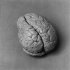 Identity of Famous 19th-Century Brain Discovered