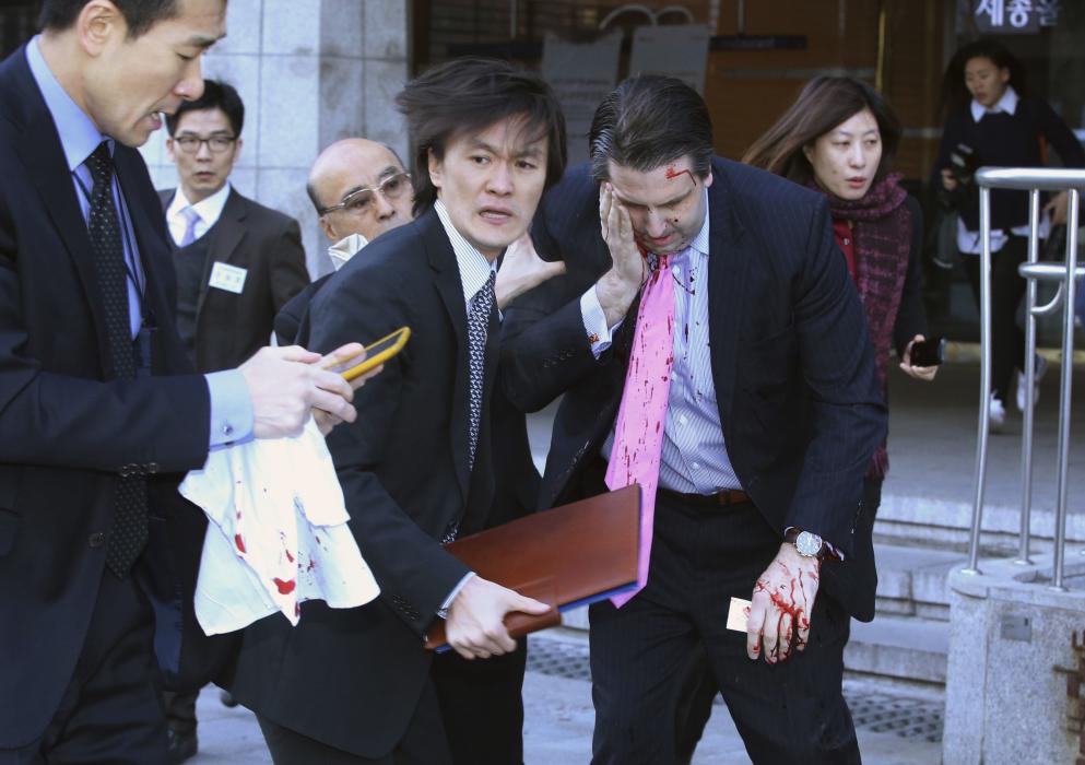 The U.S. ambassador to South Korea Mark Lippert leaves after he was slashed in the face by an unidentified assailant at a public forum in central...