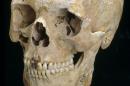 An undated handout picture released by the Natural History Museum in London on October 23, 2014 shows a skull from the Romano-British burial site in Poundbury, Dorset, dated to between 200-400 AD