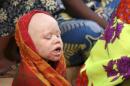 An albino child sits outside the courtroom in Ruyigi