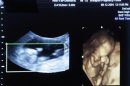 Un estudio apunta que los fetos bostezan en el vientre