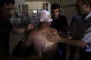 Palestinian refugee Mohammed, second name not given, 21, receives treatment in a field hospital after he was found with three gunshot wounds in town of Anadan on the outskirts of Aleppo, Syria, Monday, Aug. 6, 2012. (AP Photo)