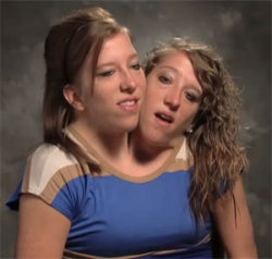 Conjoined twins blow job