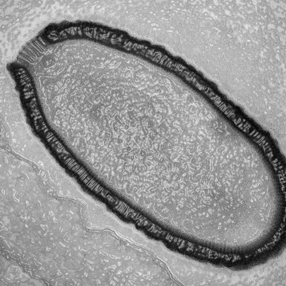 Giant Virus Resurrected from Permafrost After 30,000 Years