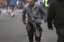 In this photo provided by The Daily Free Press and photographer Kenshin Okubo, Boston Marathon bombing victim James Costello staggers away in his torn clothing from the finish area in Boston, Monday, April 15, 2013. (AP Photo/The Daily Free Press, Kenshin Okubo) MANDATORY CREDIT