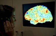 Imagem de ressonância magnética de um cérebro humano