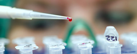Laboratory worker analyzes infection (Thinkstock)