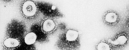 New SARS-like virus prompts urgent alert (CDC via Getty Images)