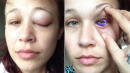 Model's Eye Tattoo Could Now Leave Her Blind: 'I Don't Want This To Happen To Anyone Else'