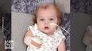 UK baby loses all 4 limbs following horrific sepsis infection