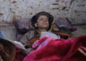 Wounded and alone, children emerge from last Islamic State enclave