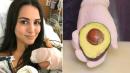 Ex-'Bachelorette' Star Andi Dorfman Sports Bandage After Serious Case of 'Avocado Hand'