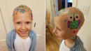 7-Year-Old Who Lost Her Hair Due to Alopecia Wins 'Crazy Hair Day' At School