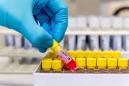 U.K. Starts Human Trials of Coronavirus Vaccine on Thursday