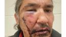 Canada indigenous chief Allan Adam battered during arrest