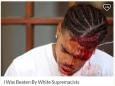 Charlottesville: Black protester Deandre Harris ‘beaten with metal poles’ by white supremacists