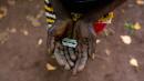 Sudan criminalises female genital mutilation (FGM)