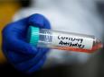 Stop pinning your hopes on coronavirus antibodies: 3 major issues mean they're no silver bullet
